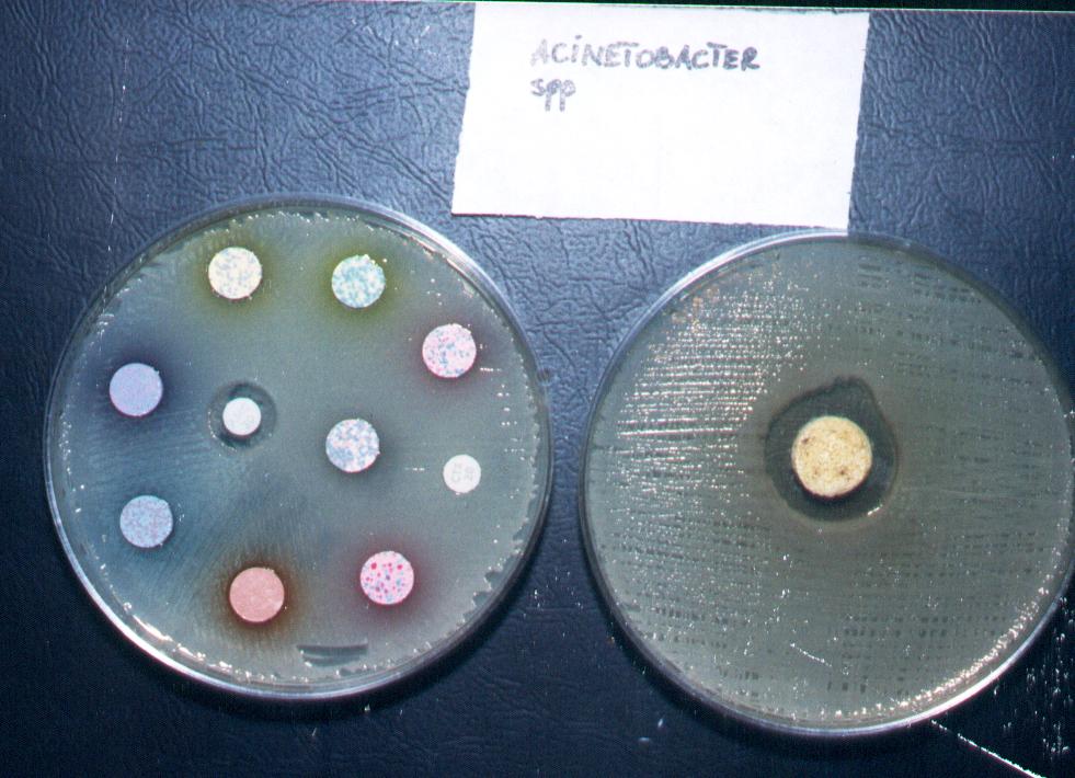 Acinetobacter.jpg