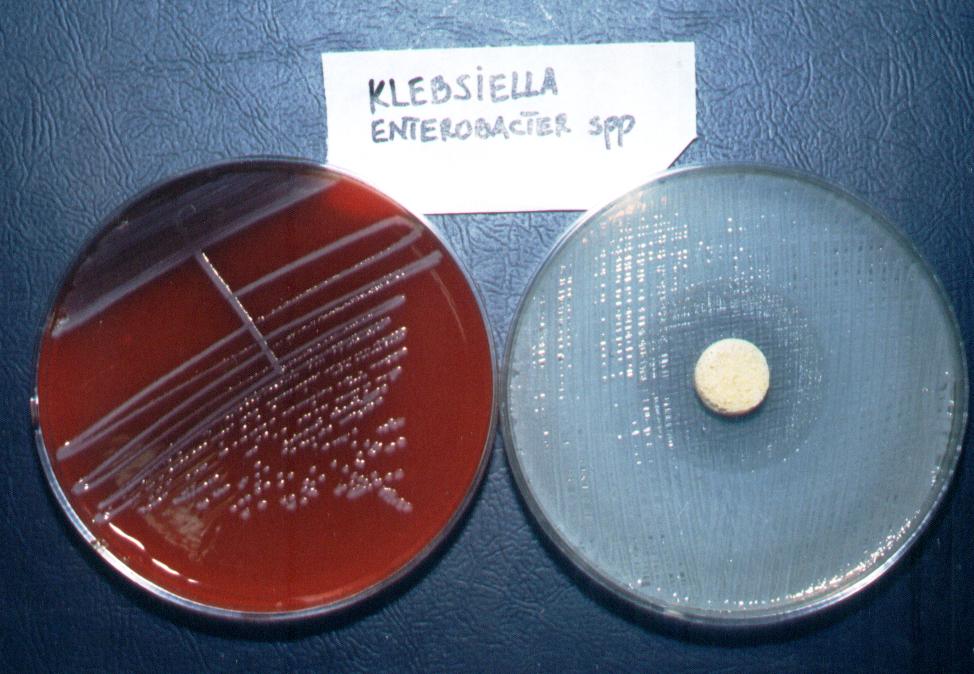 Klebsiella.jpg