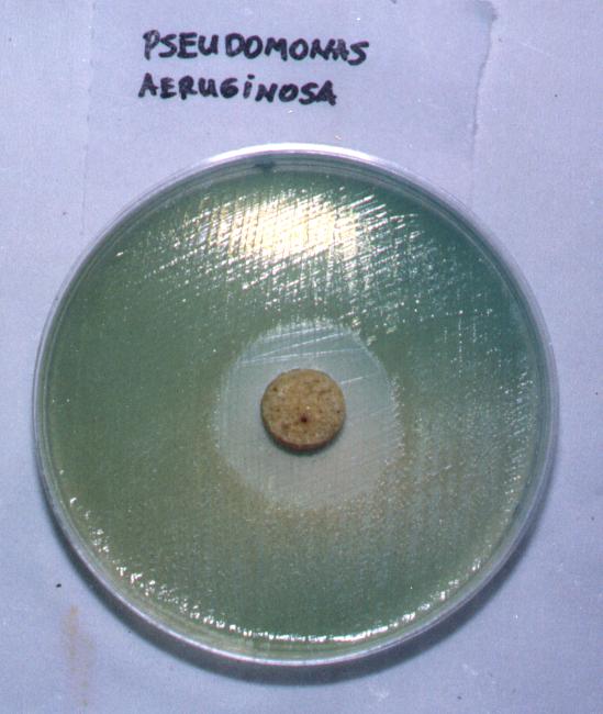 Pseudomonas aeruginosa.jpg