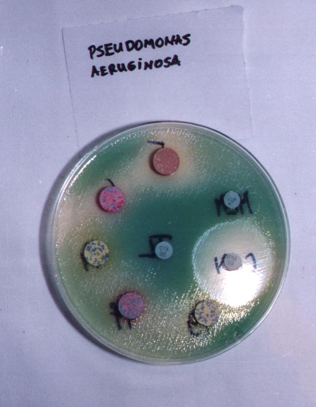 Pseudomonas.jpg